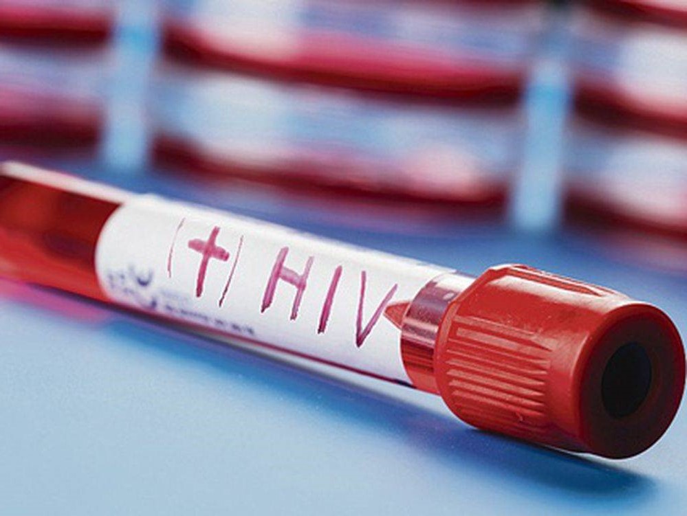 پیشگیری از HIV