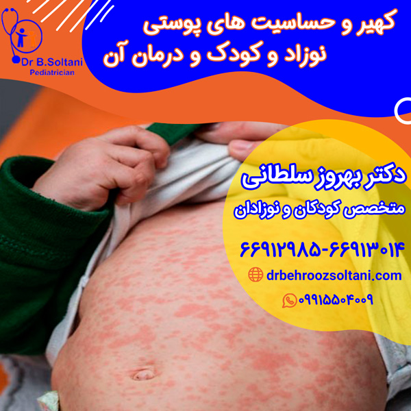 کهیر و حساسیت های پوستی نوزاد و کودک و درمان آن دکتر بهروز سلطانی