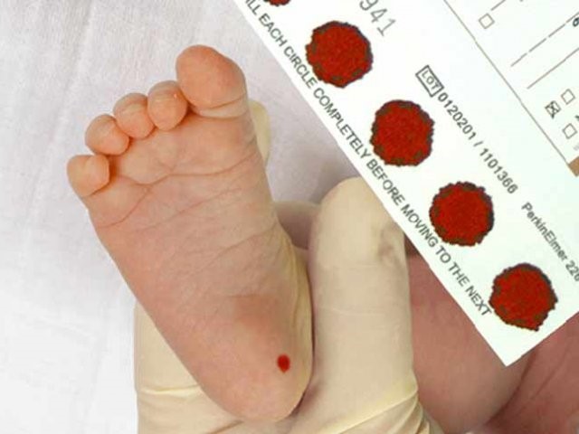 آزمایش خون نوزادان