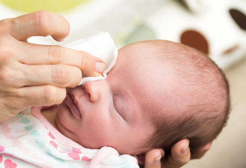 درمان قِی کردن چشم نوزادان و چسبندگی پلک ها