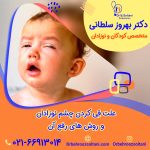 علت قِی کردن چشم نوزادان و روش های رفع آن