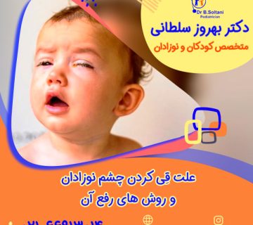 علت قِی کردن چشم نوزادان و روش های رفع آن