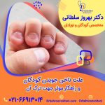 علت ناخن جویدن کودکان و راهکار موثر جهت ترک آن