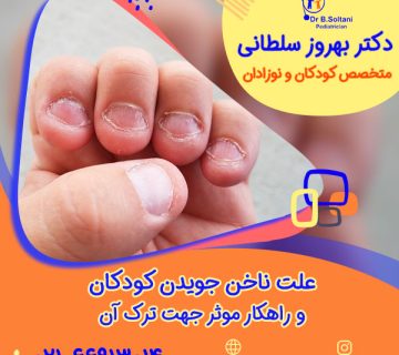 علت ناخن جویدن کودکان و راهکار موثر جهت ترک آن